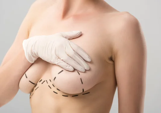 Breast Lift | Plastic Surgery Indian Breast Lift | Plastic Surgery Indian