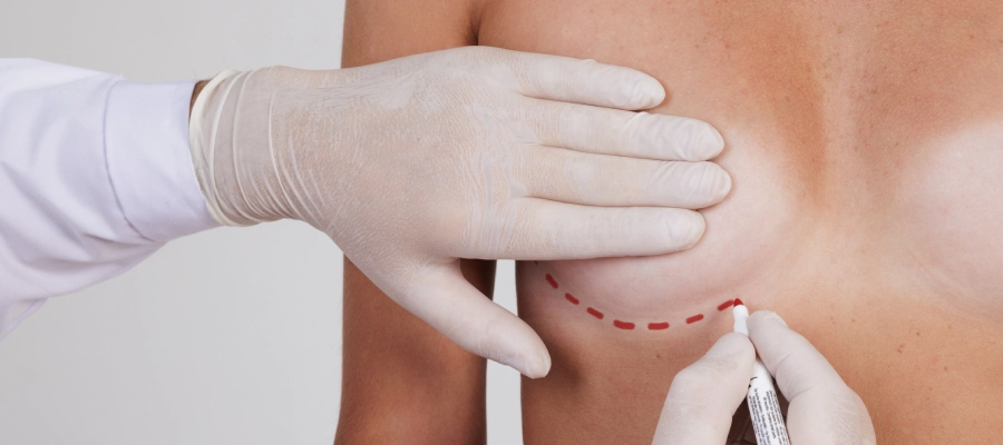 Breast Surgery | Plastic Surgery Indian Breast Surgery | Plastic Surgery Indian