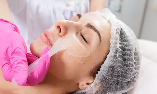 Chemical Peeling
