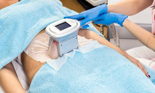Coolsculpting