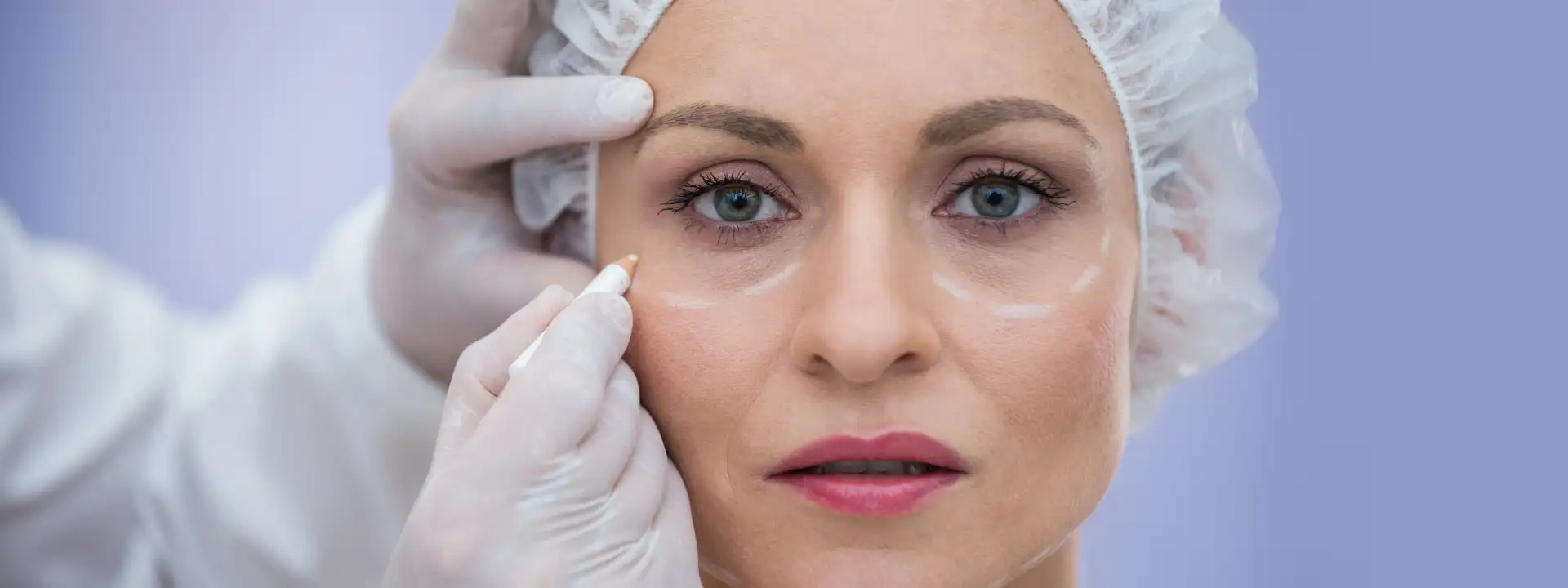 What Is Eyelid Surgery or Blepharoplasty?