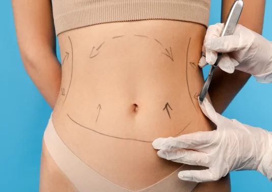 Liposuction | Plastic Surgery Indian Liposuction | Plastic Surgery Indian