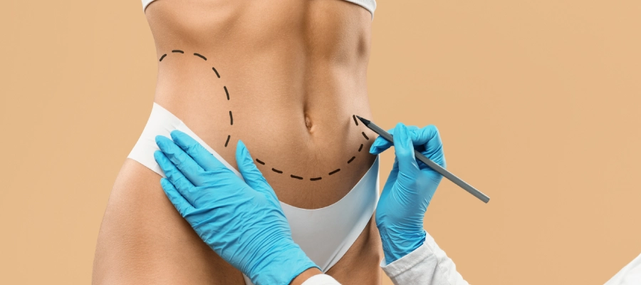 Liposuction | Plastic Surgery Indian Liposuction | Plastic Surgery Indian