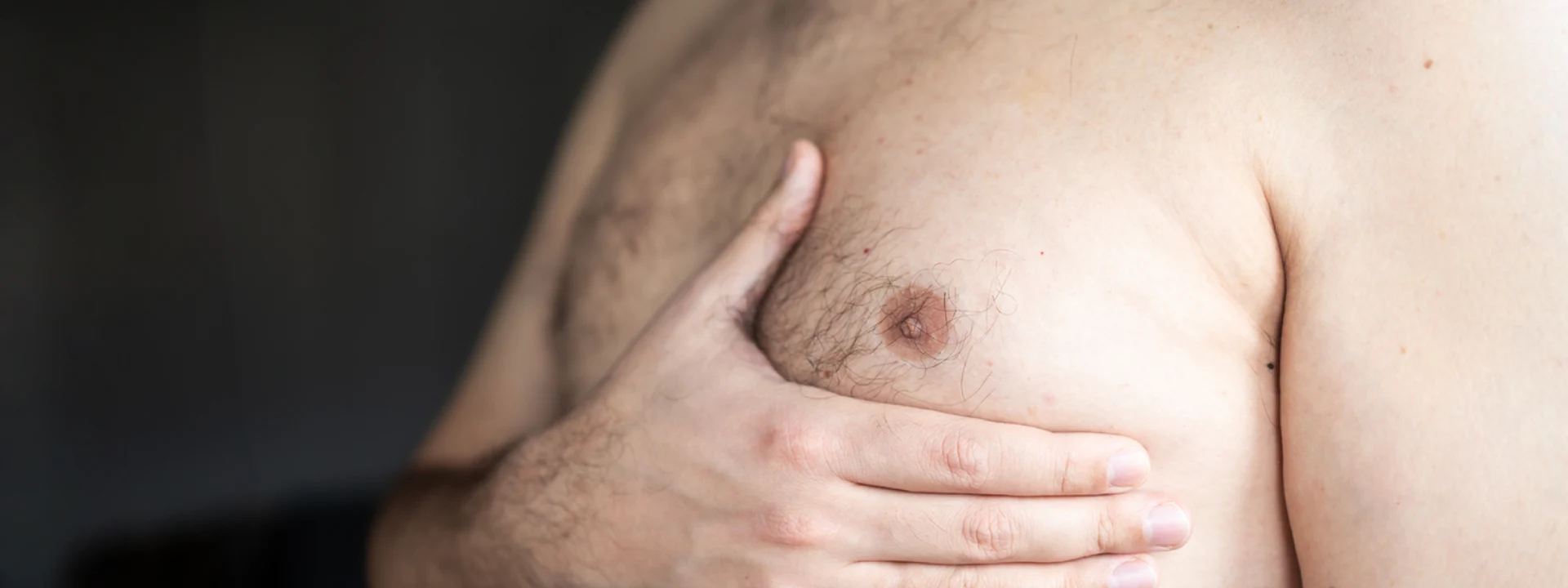What Is Gynecomastia? What Is Gynecomastia?