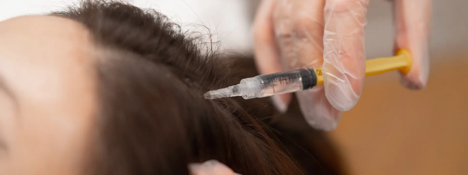 What Is PRP Treatment?