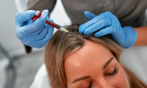 PRP Treatments