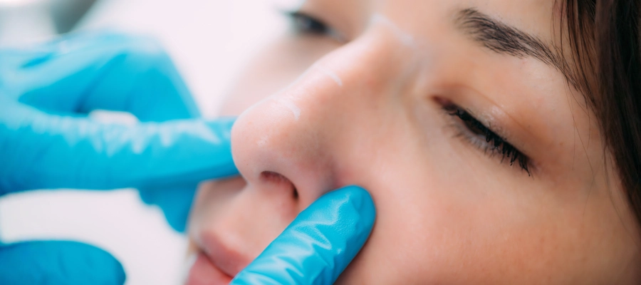Rhinoplasty | Plastic Surgery Indian Rhinoplasty | Plastic Surgery Indian