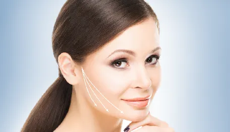 Facial Implants