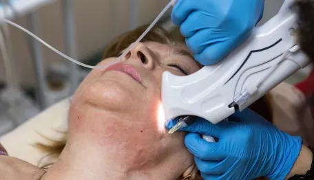 Facial Veins