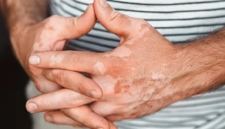 Skin Pigments