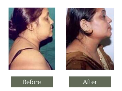 Miscellaneous, Dr. Manoj Khanna Miscellaneous, Dr. Manoj Khanna