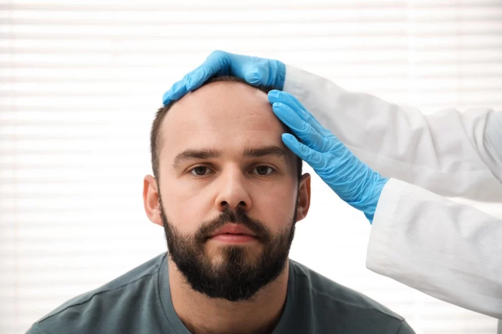 FUE vs FUT hair transplant