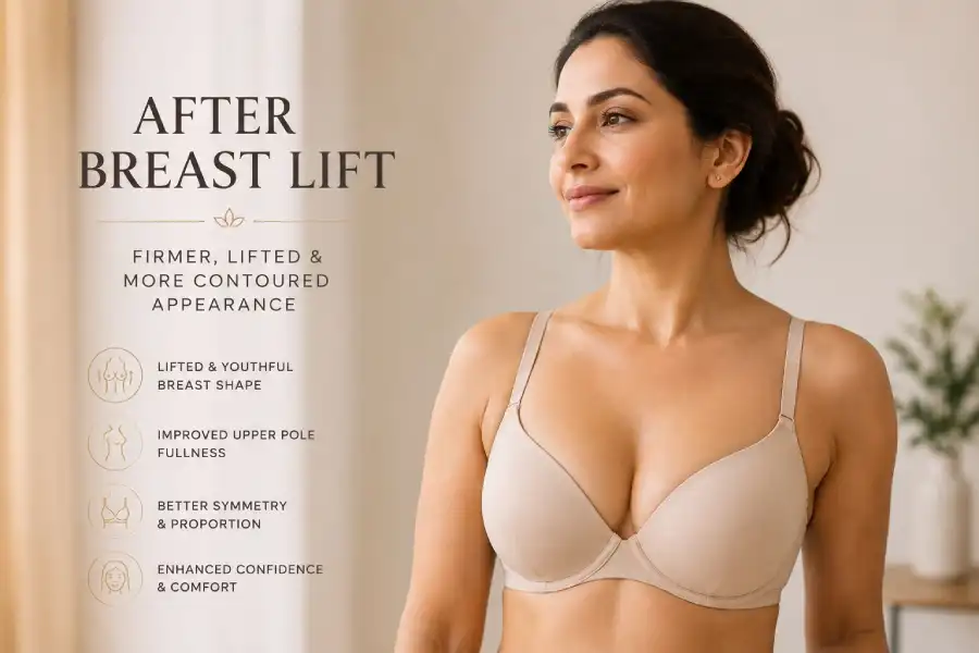 Breast Lift With or Without Implants