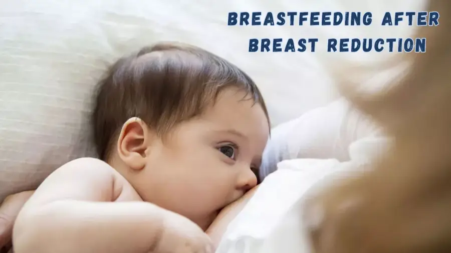 Breastfeeding After Breast Reduction: What You Need to Know
