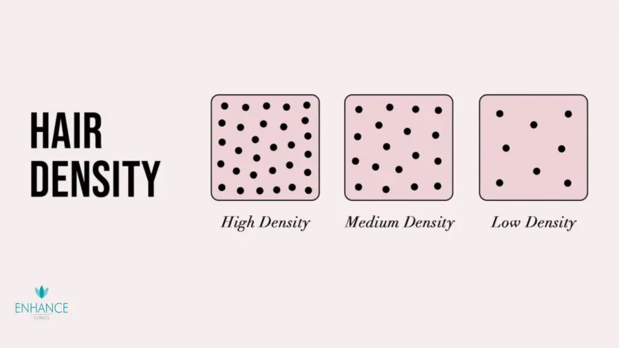 Density in Hair Transplant: Why It Matters for Natural-Looking Results
