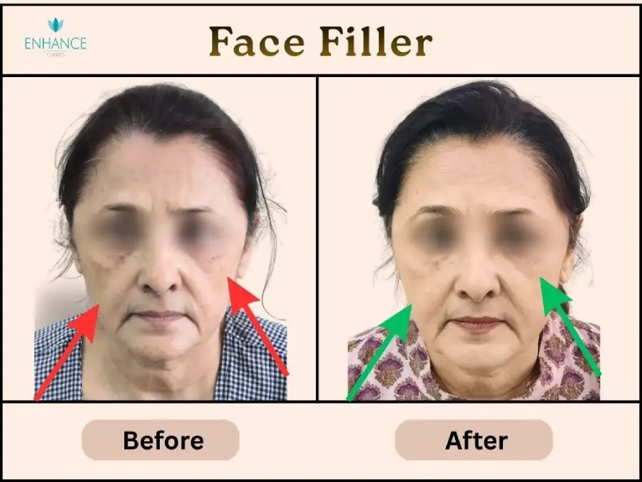 What Happens to the Face as We Age?